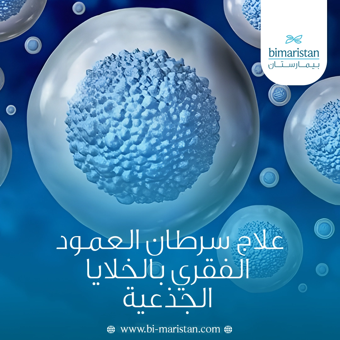 علاج سرطان العمود الفقري بالخلايا الجذعية