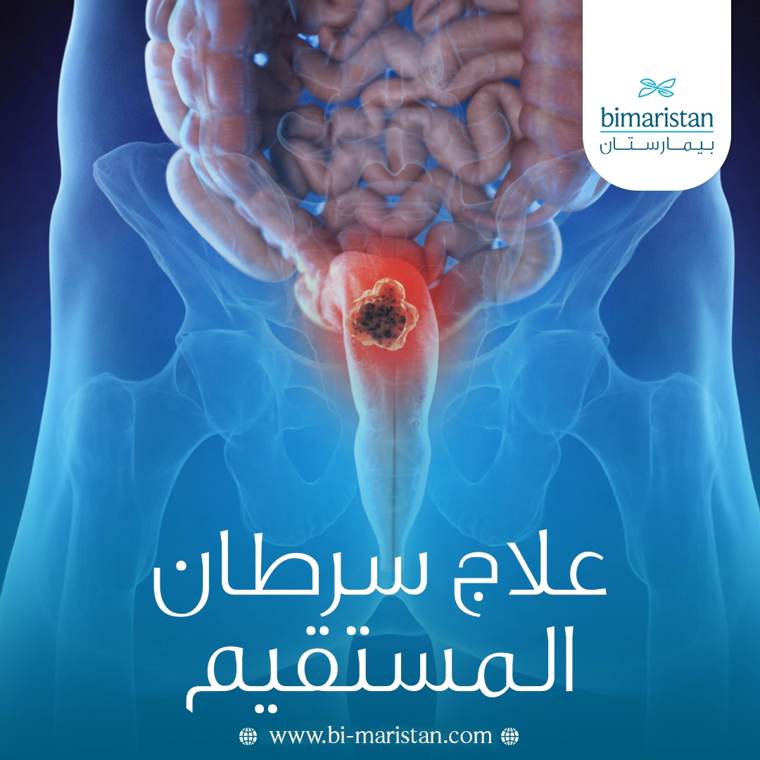 علاج سرطان المستقيم