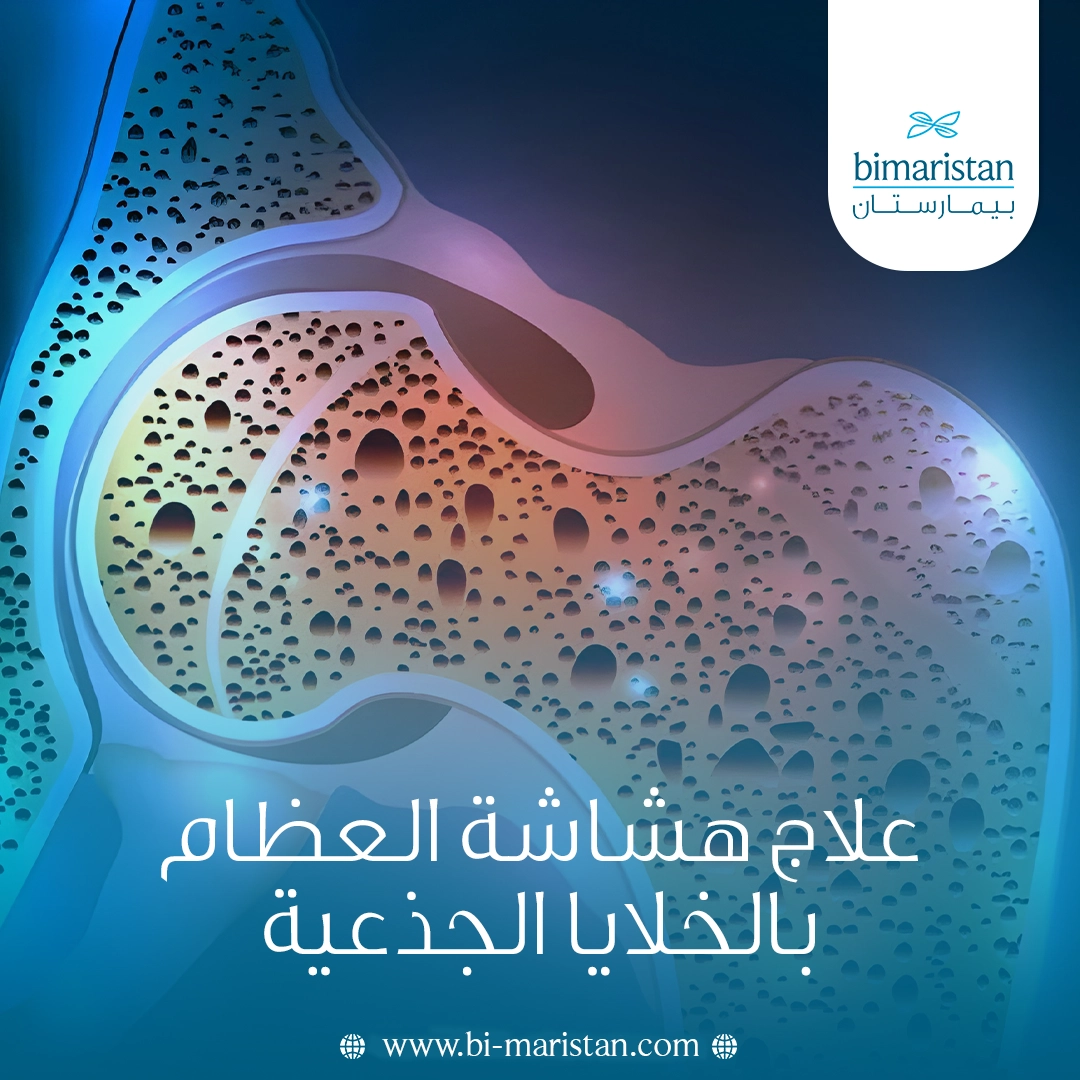علاج هشاشة العظام بالخلايا الجذعية