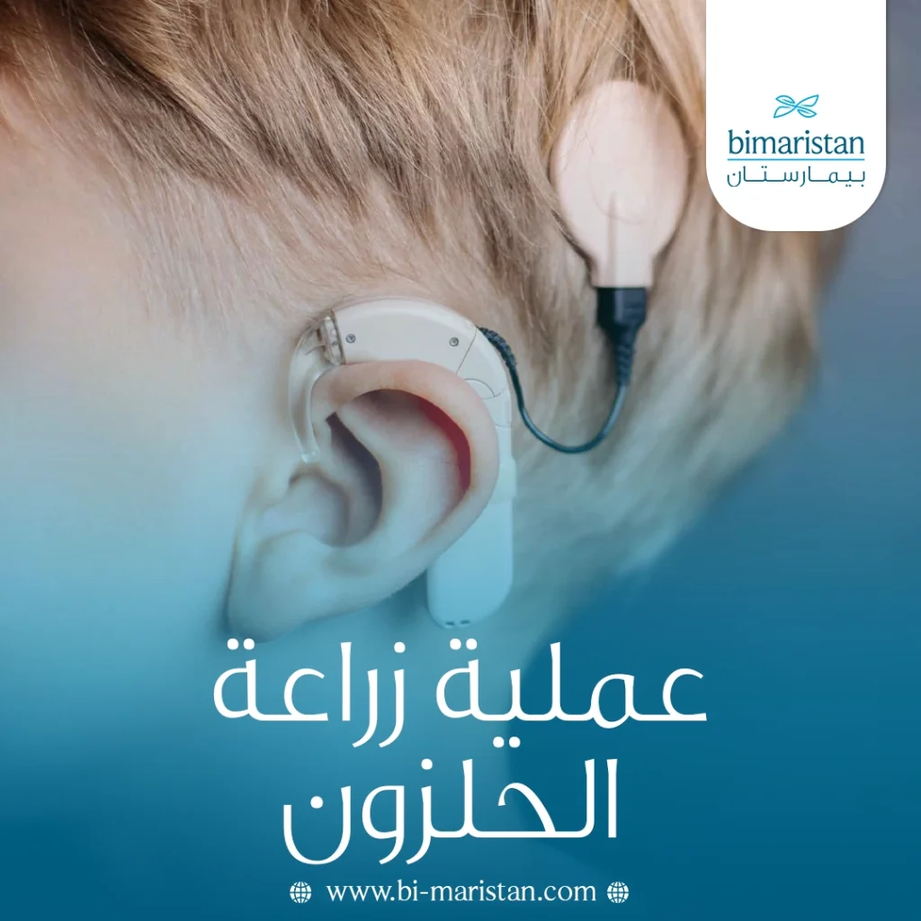 عملية زراعة الحلزون