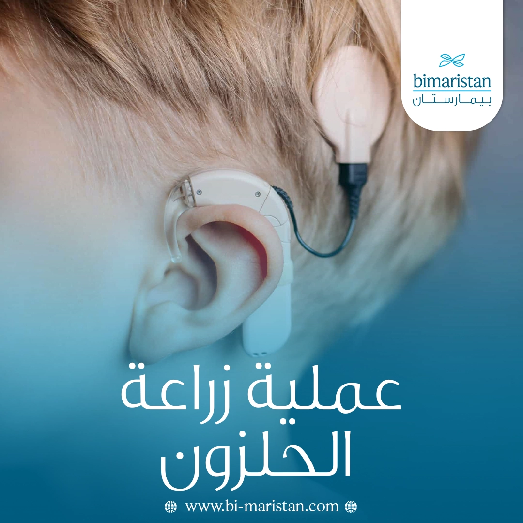 عملية زراعة الحلزون