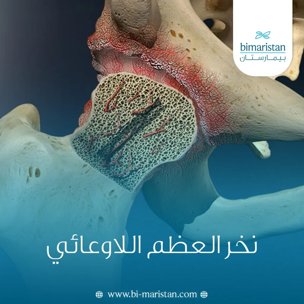 نخر العظم اللاوعائي