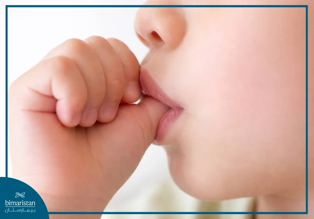 صورة توضح العادات الفموية السئية للأطفال والتي تؤثر سلباً على نمو الأسنان والتي تعد استطباب لتقويم الأسنان