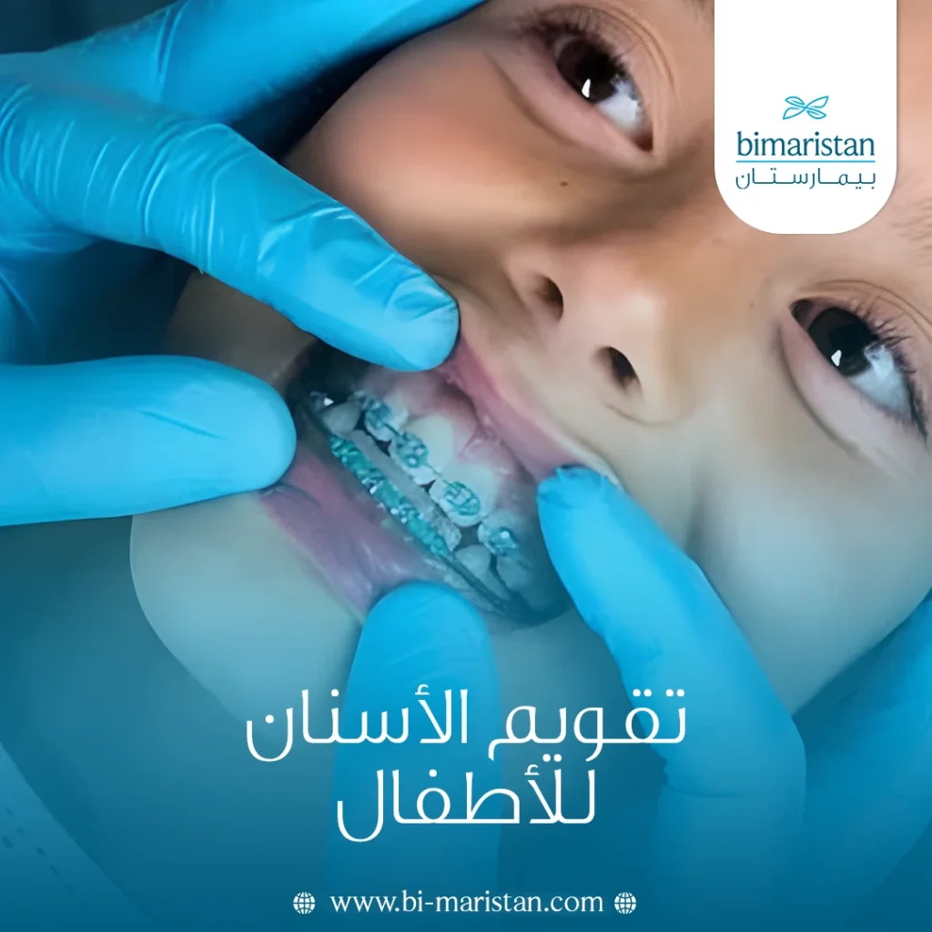 تقويم الأسنان للأطفال