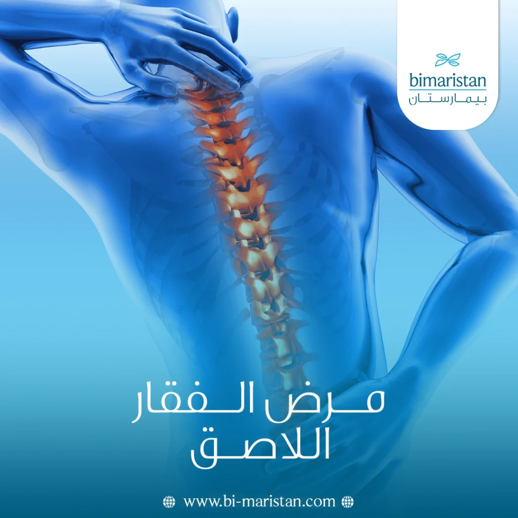 مرض الفقار اللاصق: عدو العمود الفقري المستتر 6 مرض الفقار اللاصق