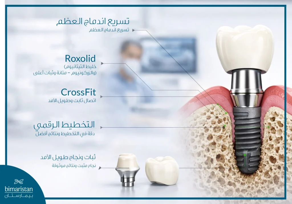صورة توضح مميزات زرعات سترومان السويسرية