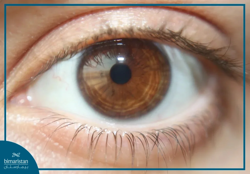 Addiction Au Lyrica Et Au Tramadol