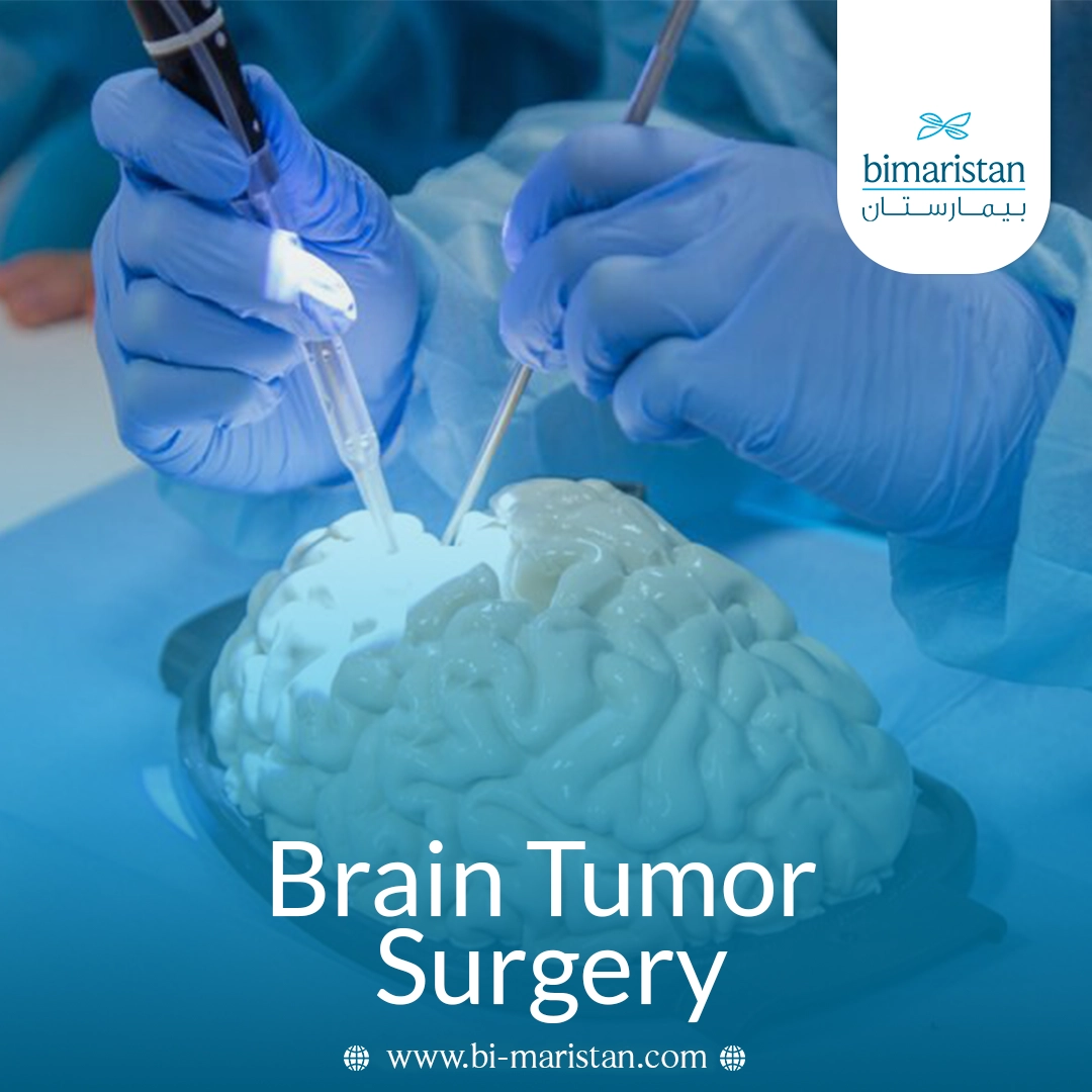 Brain Tumor Surgery