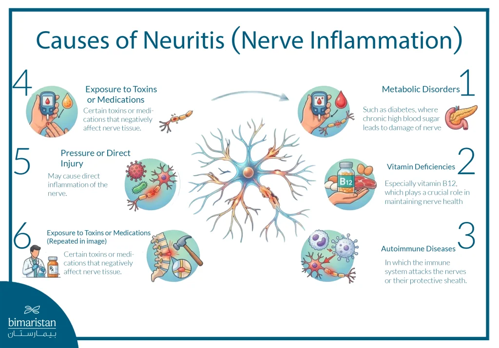 Causes Of Neuritis