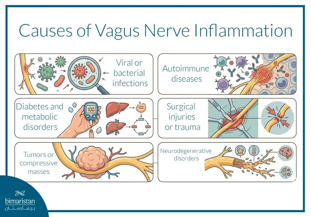 Causes Of Vagus Nerve Inflammation