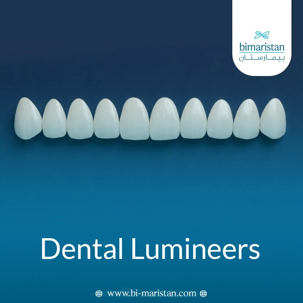 Dental Lumineers: The Secret To An Attractive Smile 4 Dental Lumineers