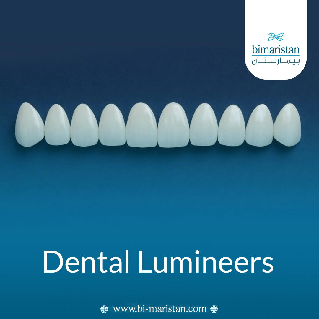 Dental Lumineers