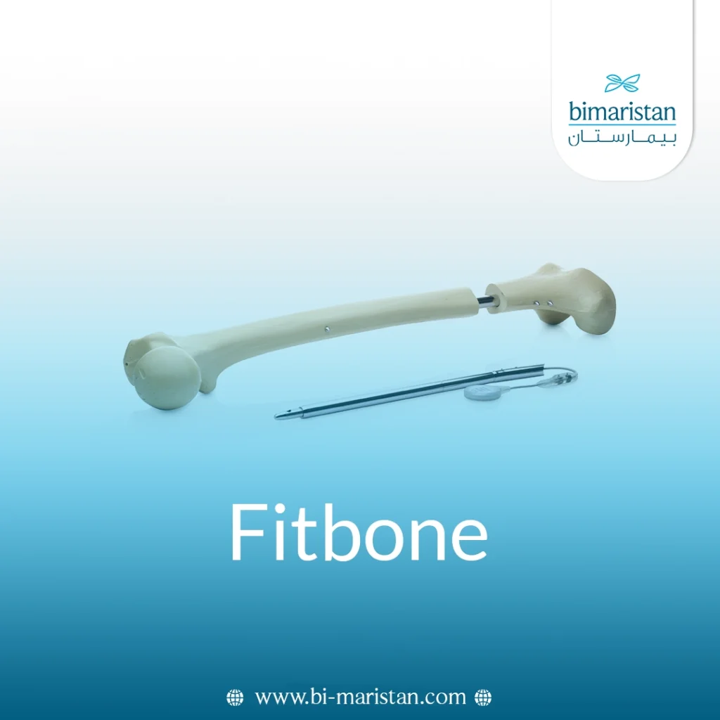 Fitbone
