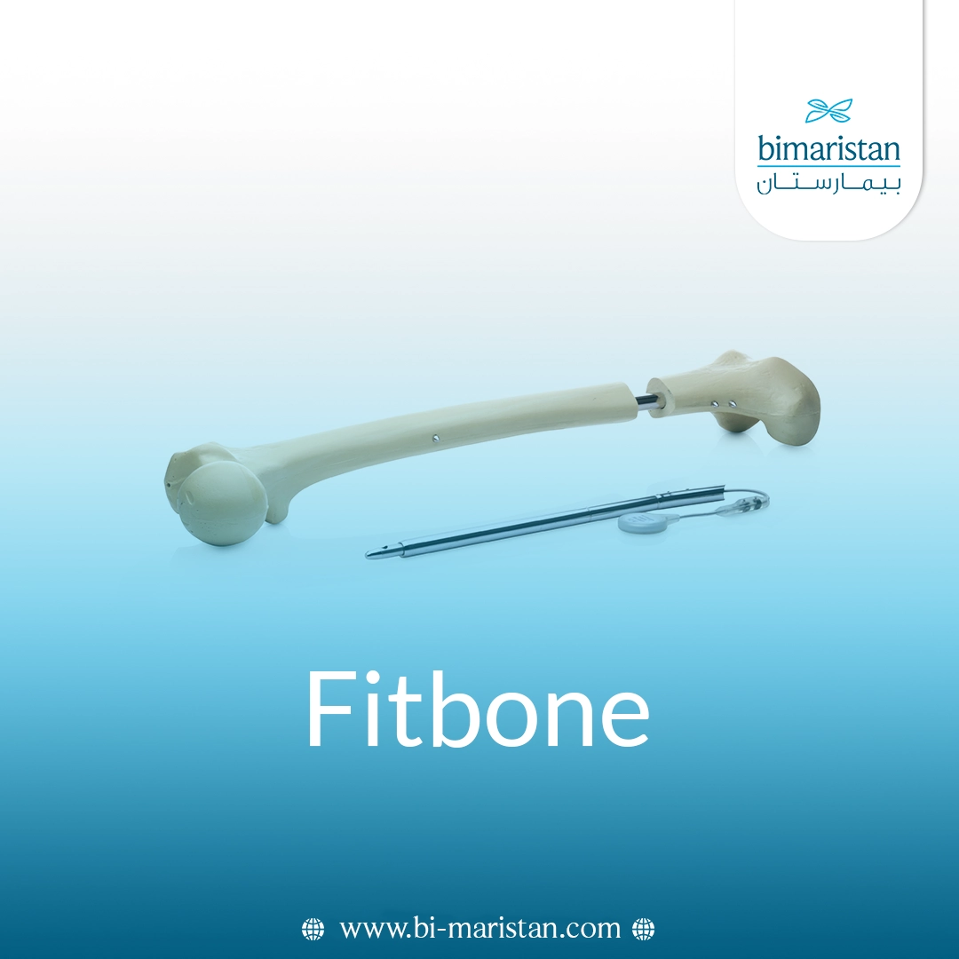 Fitbone