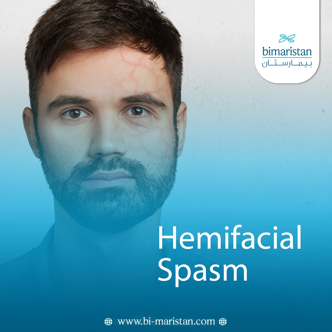 Hemifacial Spasm: Causes, Symptoms, And Treatment