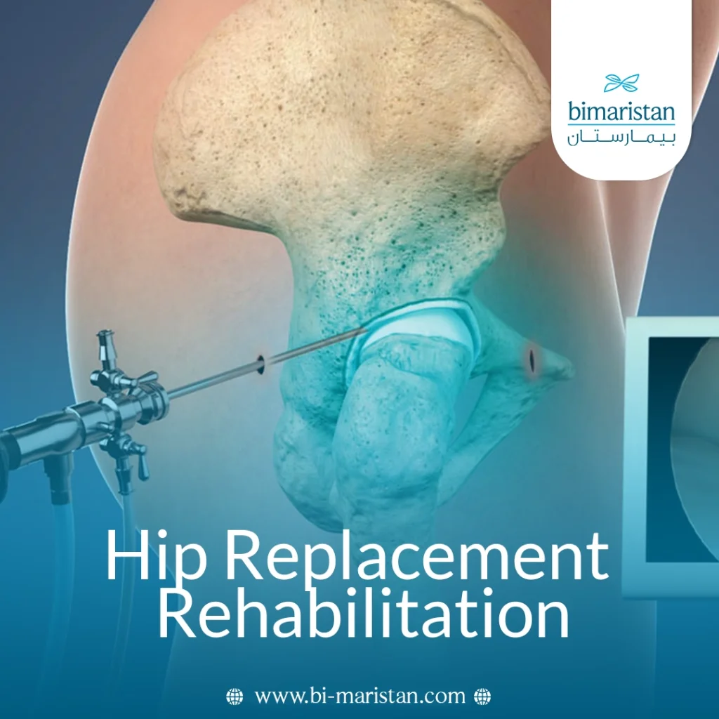 Hip Replacement Rehabilitation