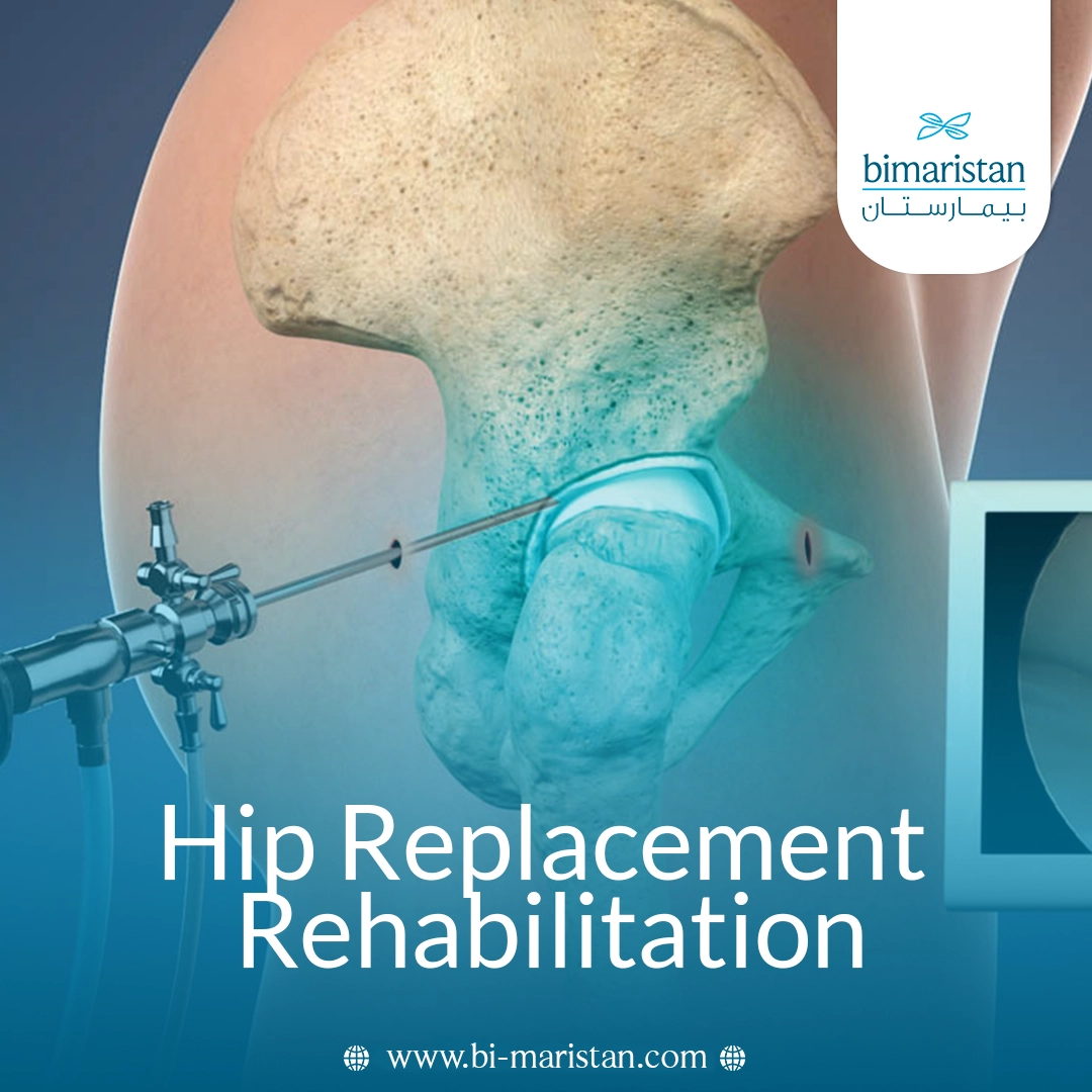 Hip Replacement Rehabilitation