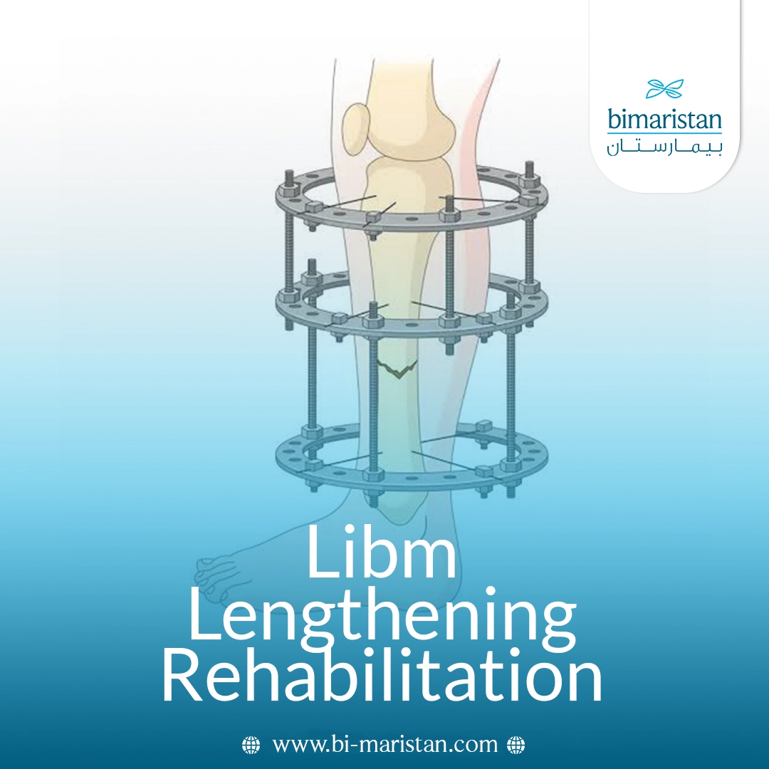Libm Lengthening Rehabilitation