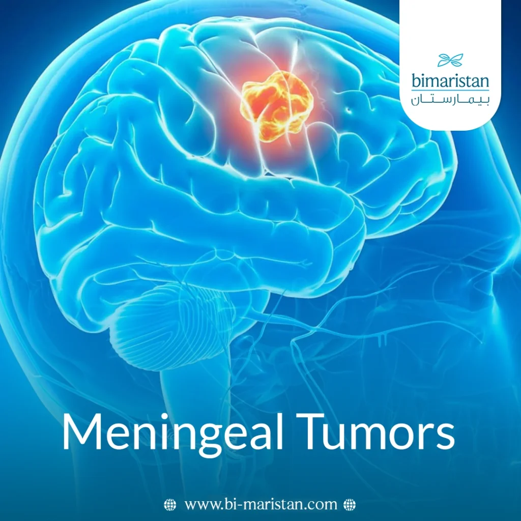Meningeal Tumors