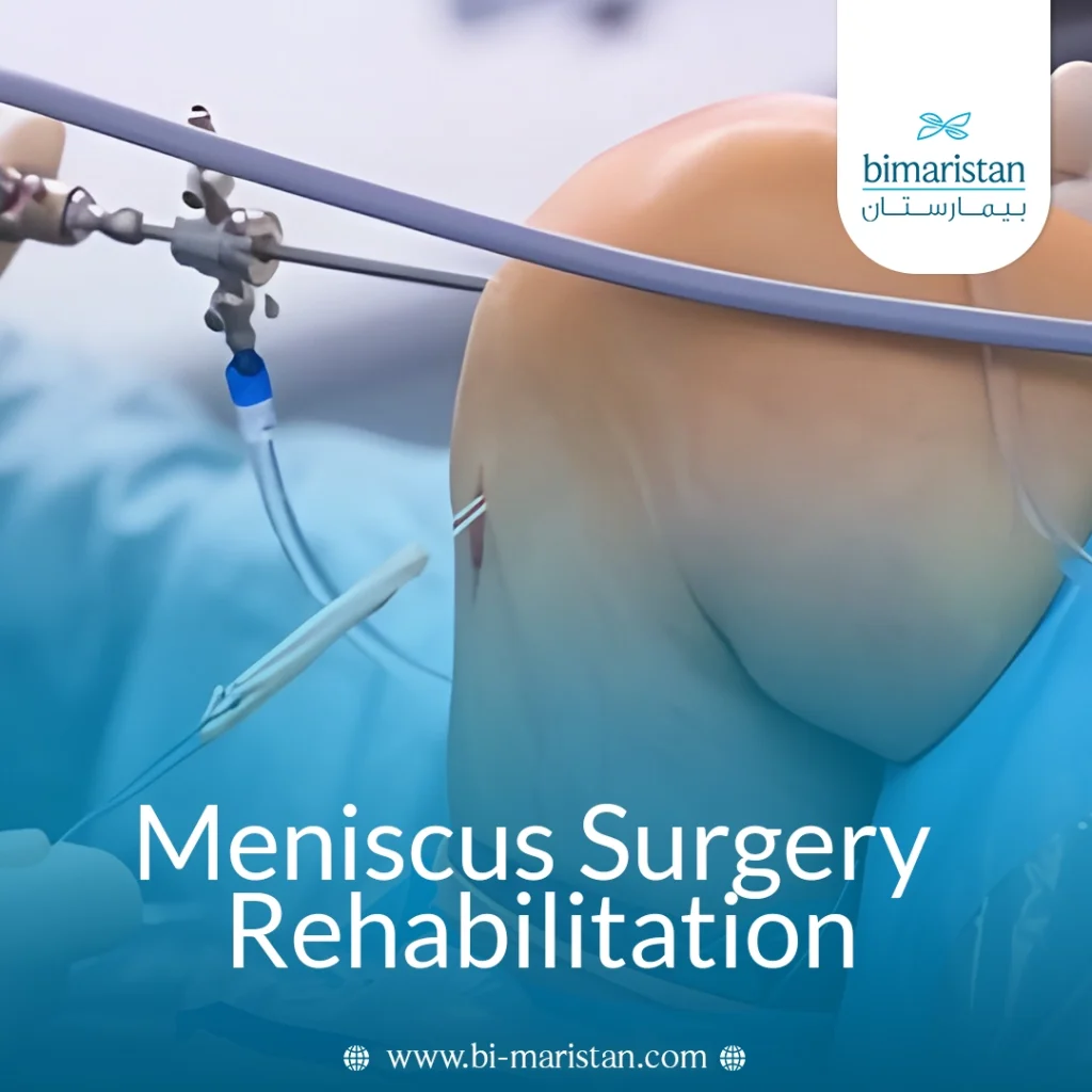 Meniscus Surgery Rehabilitation 4 Meniscus Surgery Rehabilitation
