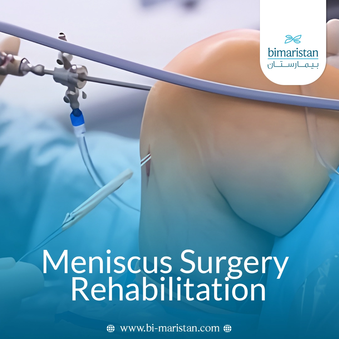 Meniscus Surgery Rehabilitation
