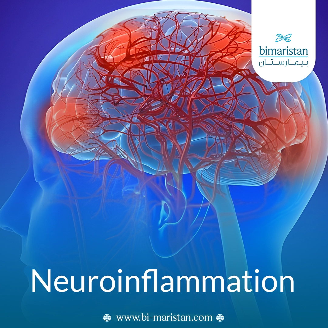 Neuroinflammation