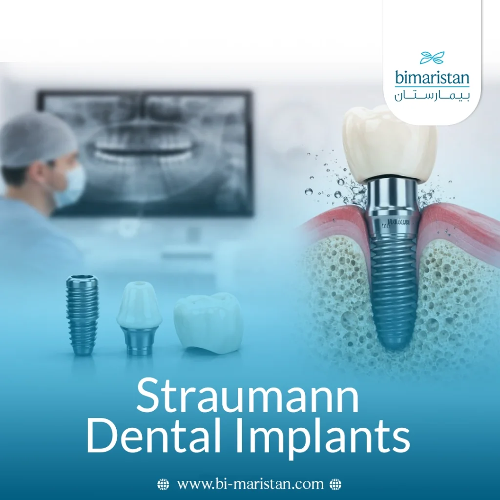 Straumann Dental Implants
