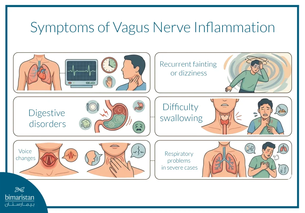Symptoms Of Vagus Nerve Inflammation