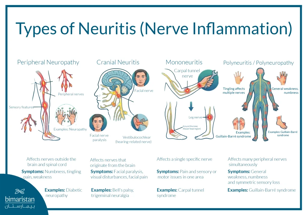 Types Of Neuritis