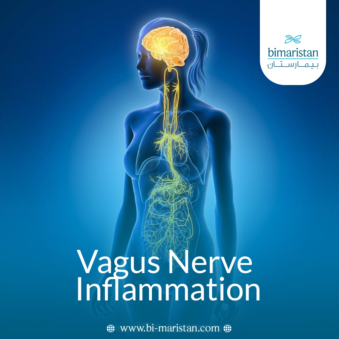 Vagus Nerve Inflammation: Symptoms, Causes, And Treatment Options
