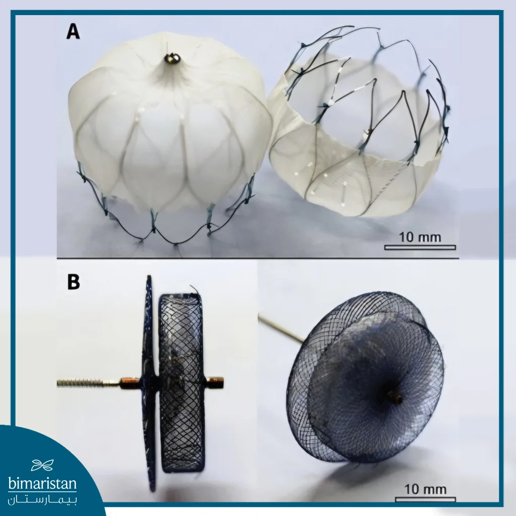 صورة لأجهزة تُستخدم في إغلاق الزائدة الأذينية اليسرى عبر القسطرة، حيث يُظهر (A) جهاز Watchman ويُظهر (B) جهاز Amplatzer Amulet، مع توضيح الحجم التقريبي (10 مم)