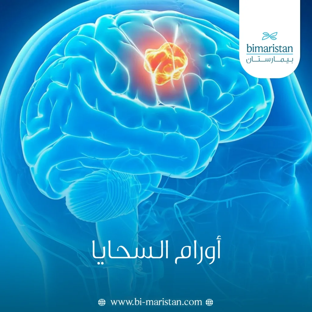 أورام السحايا