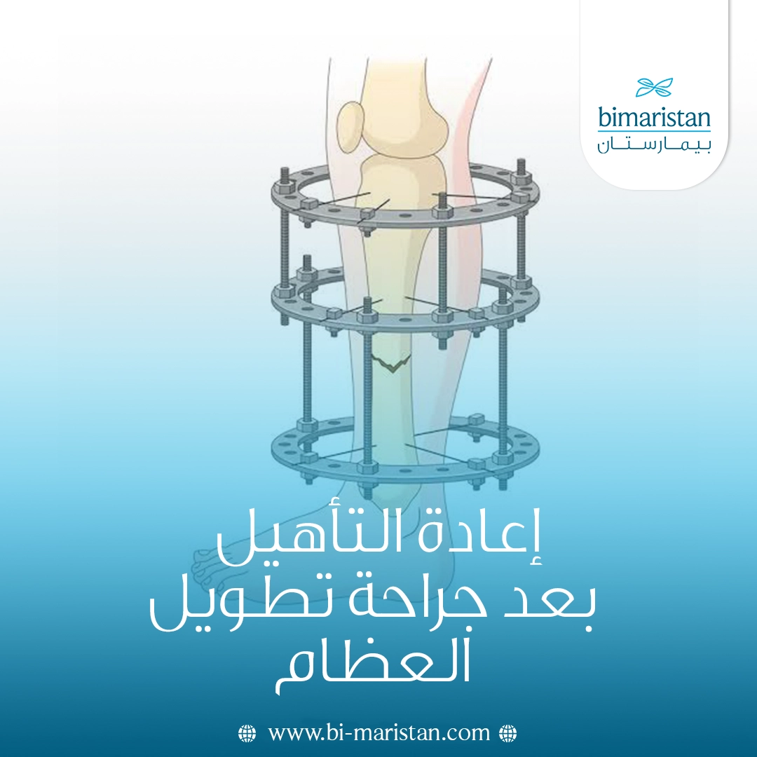 إعادة التأهيل بعد جراحة تطويل العظام