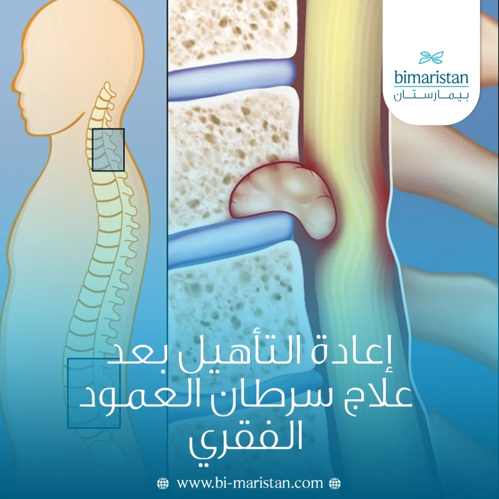 إعادة التأهيل بعد علاج سرطان العمود الفقري