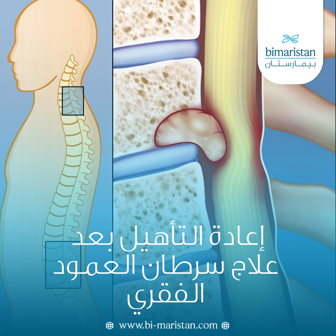 إعادة التأهيل بعد علاج سرطان العمود الفقري