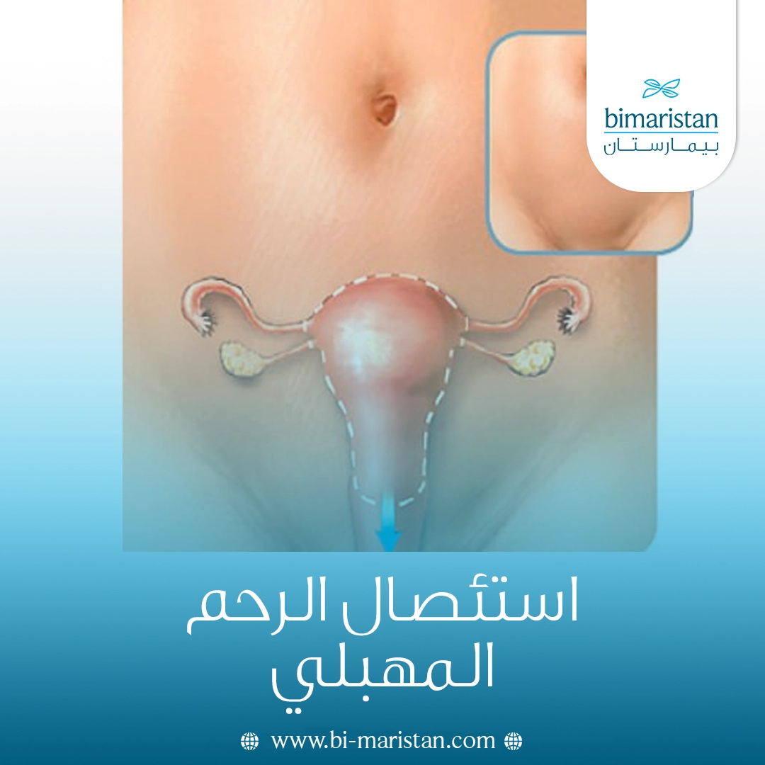 استئصال الرحم المهبلي