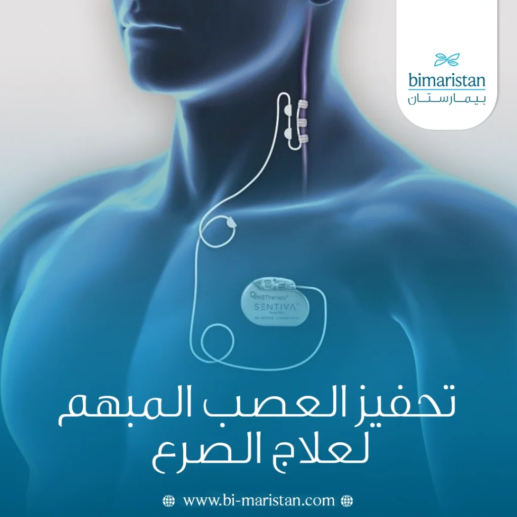 تحفيز العصب المبهم لعلاج الصرع