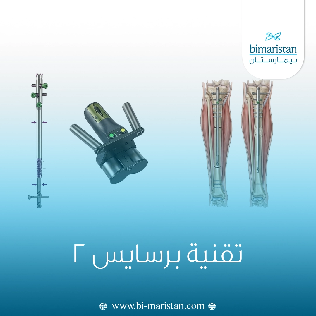 تقنية برسايس 2