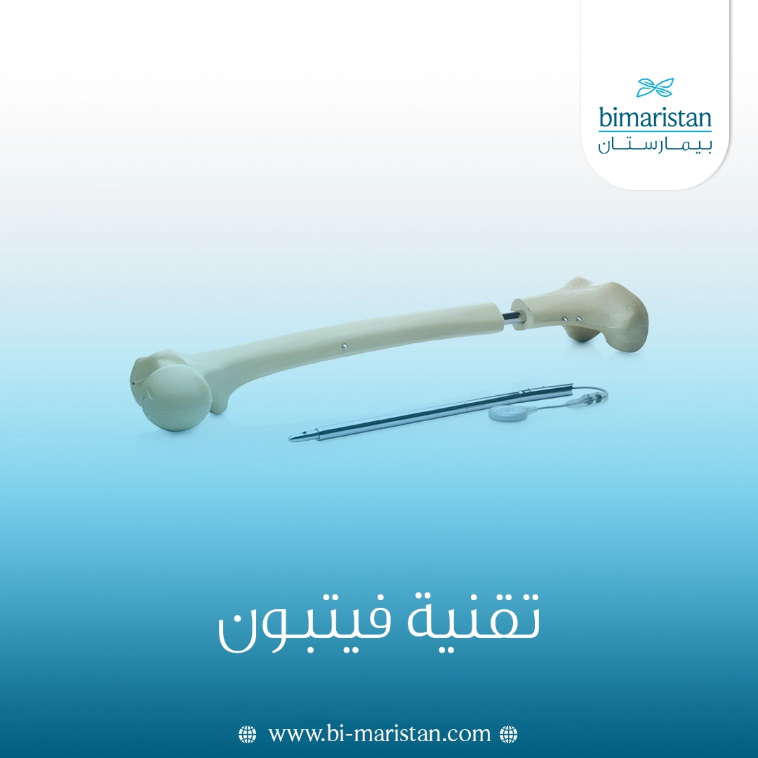 تقنية فيتبون