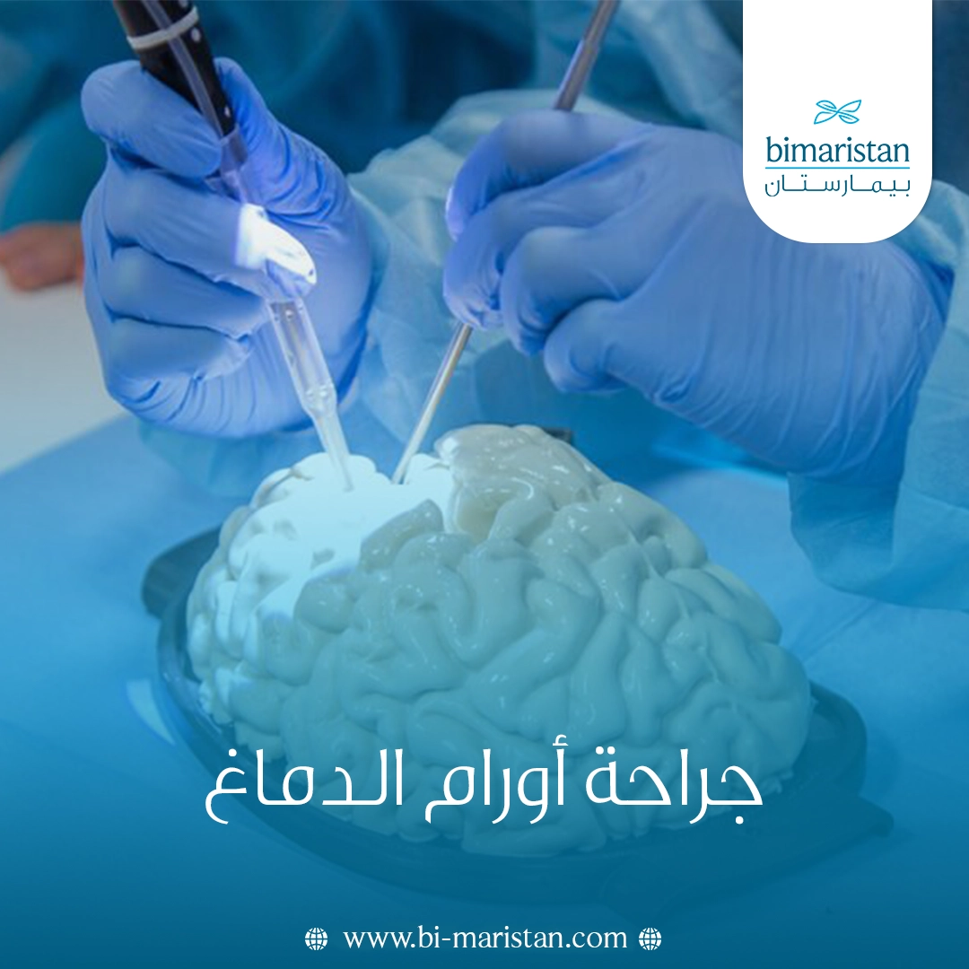 جراحة أورام الدماغ