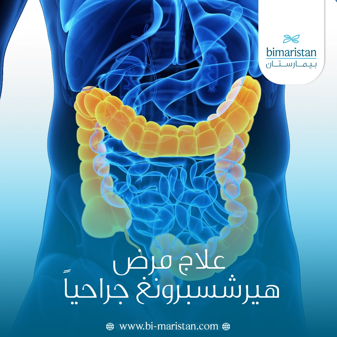 علاج مرض هيرشسبرونغ جراحياً