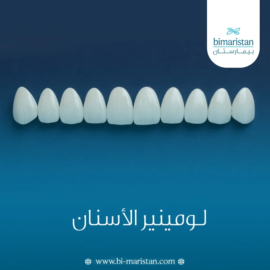 لومينير الأسنان