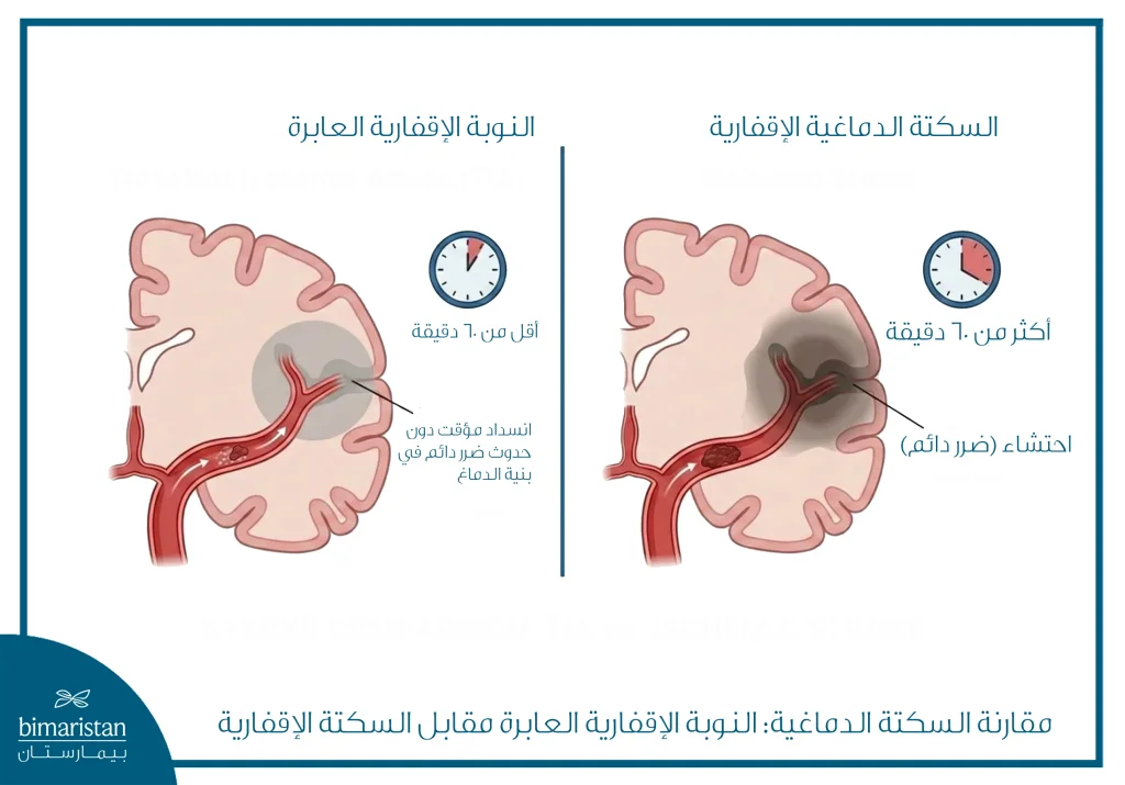 الفرق بين النوبة الإقفارية العابرة مقابل السكتة الإقفارية