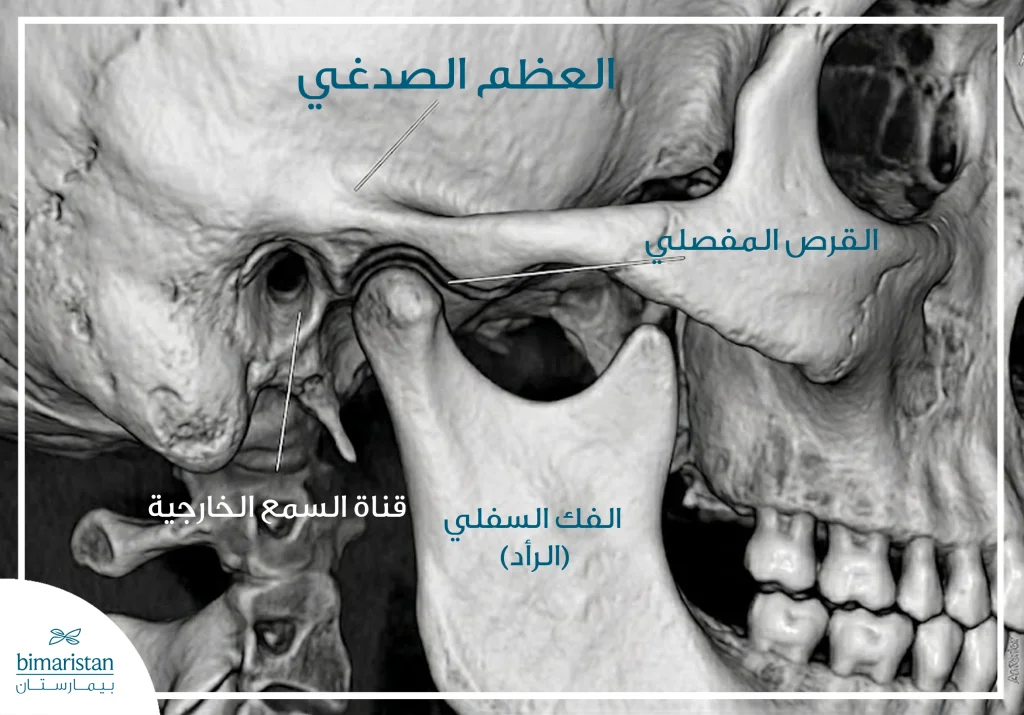 صورة مقطعية ثلاثية الأبعاد للمفصل الفكي الصدغي