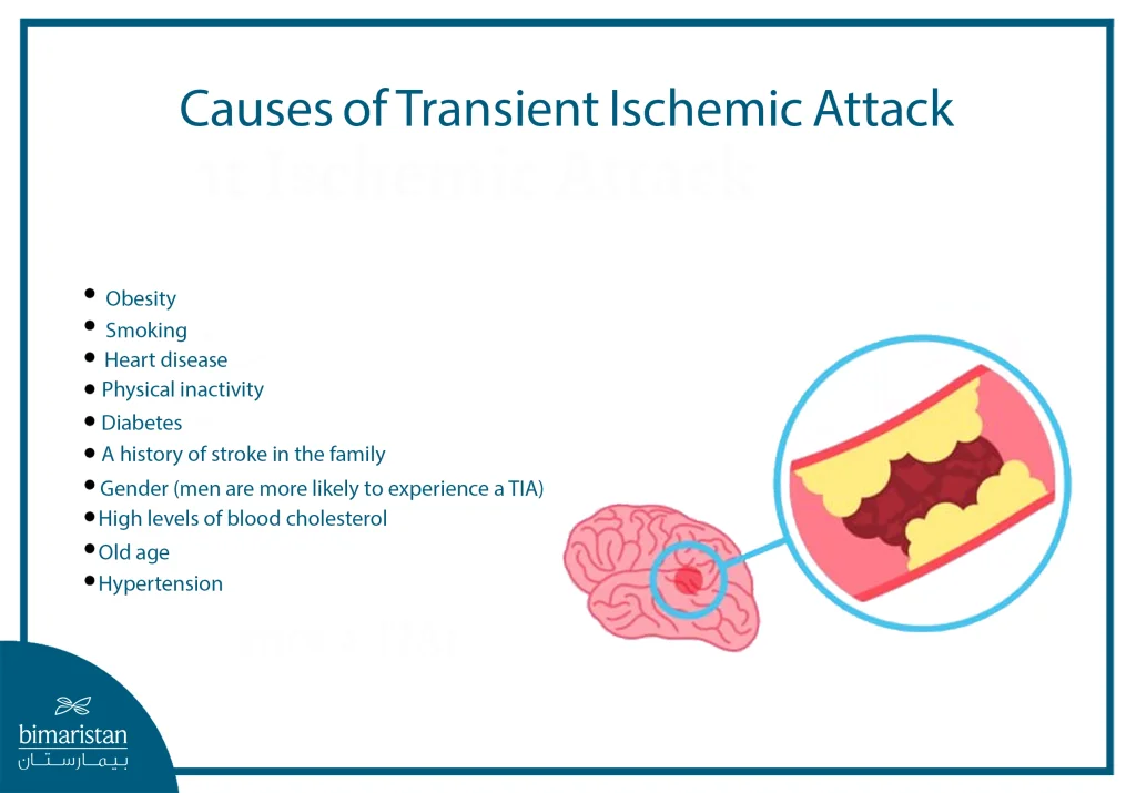 Transient Ischemic Attack: Causes, Symptoms, And Treatment Options 4 Causes Of A Transient Ischemic Attack