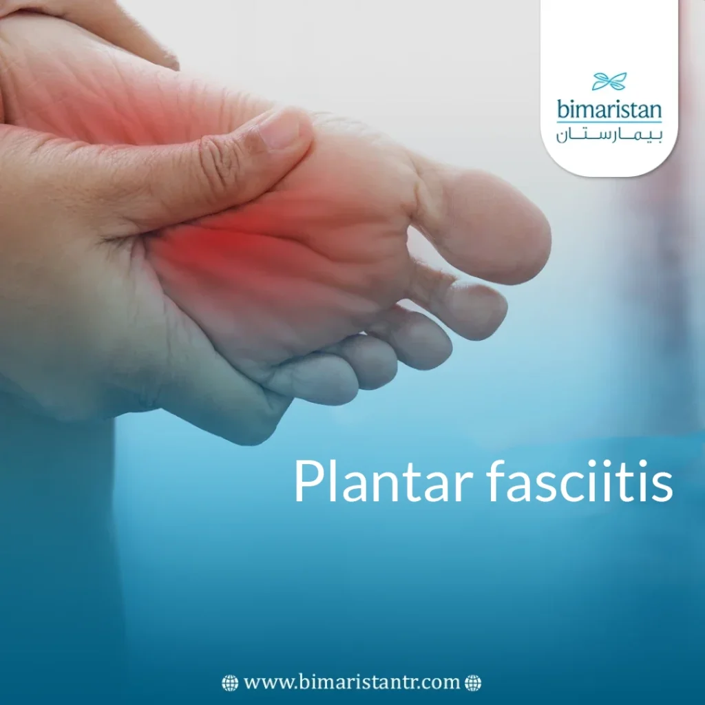 Plantar Fasciitis