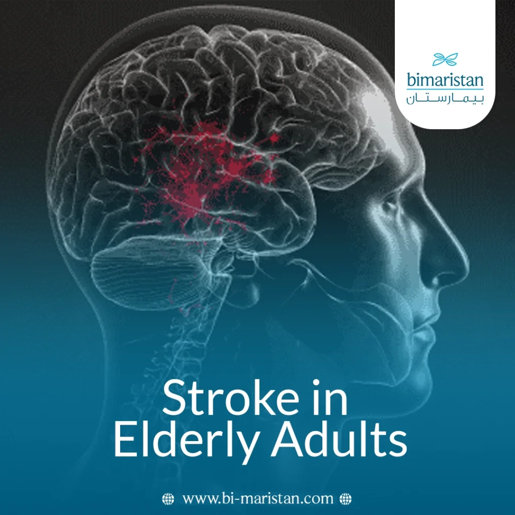 Stroke In Elderly Adults