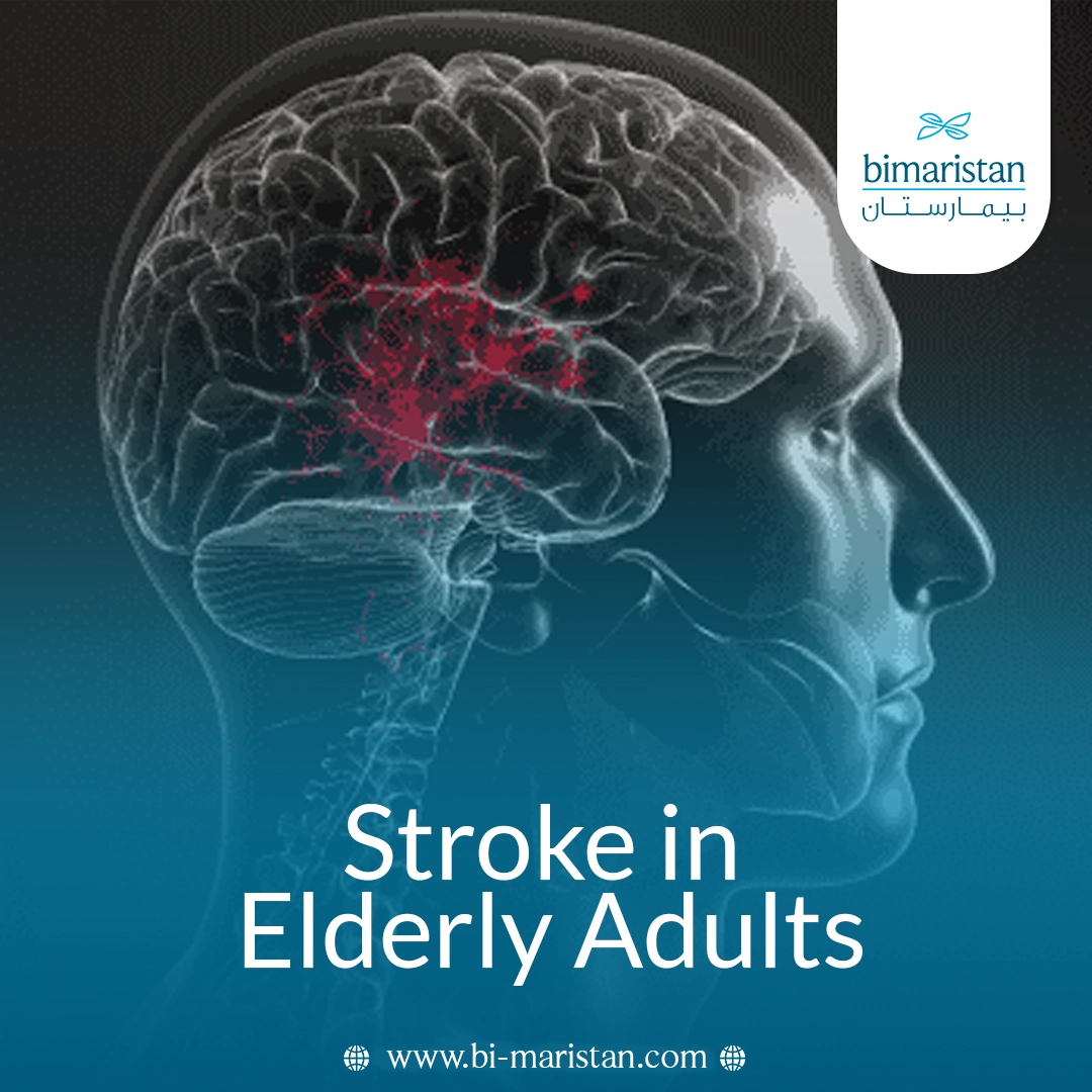 Stroke In Elderly Adults: Causes, Symptoms, And Treatment Options