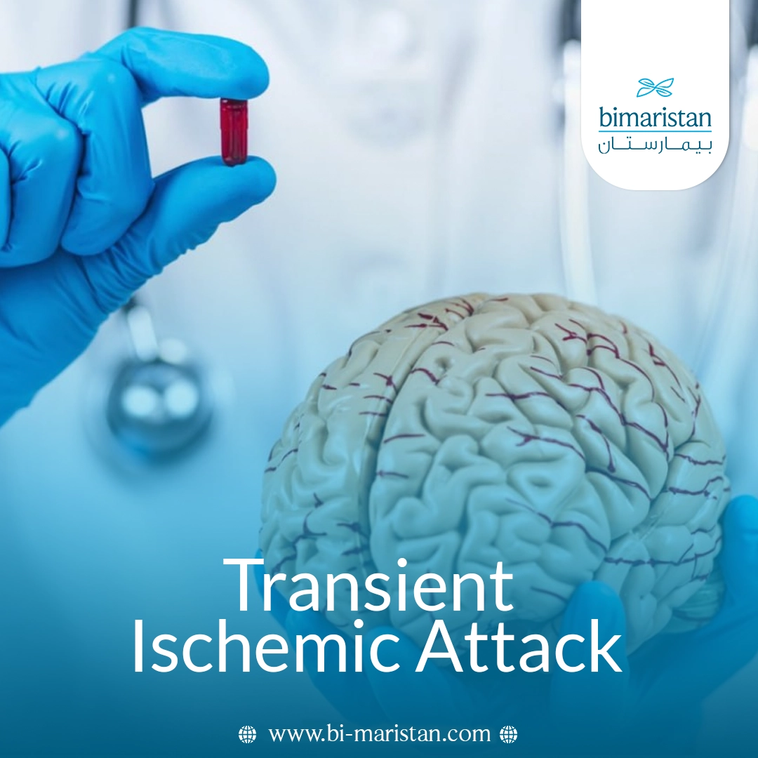 Transient Ischemic Attack