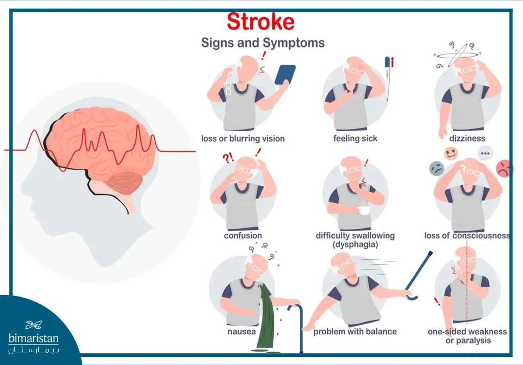Common Symptoms Of Stroke In Elderly Adults